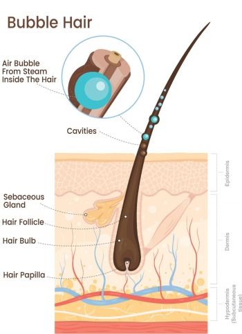 Fio de cabelo com bubble hair. Dano causado pelo secador.