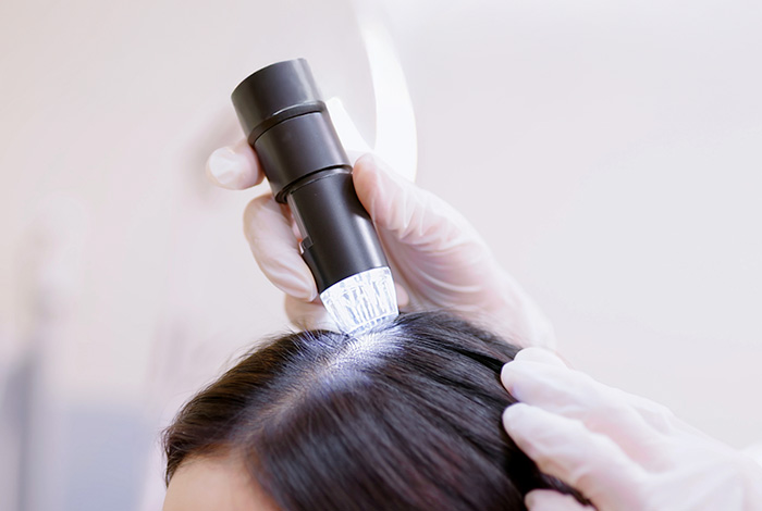 Pessoa usando luvas realiza exame no couro cabeludo de uma paciente com uma ferramenta de luz para análise capilar.