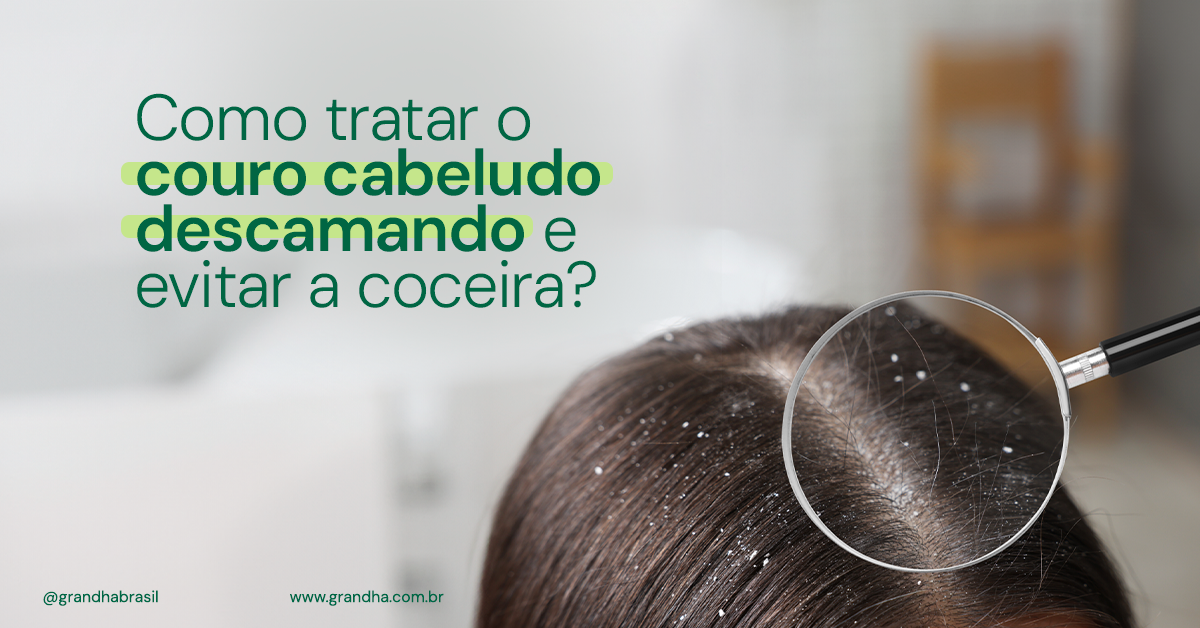 Como tratar o couro cabeludo descamativo e com coceira? - Grandha ...