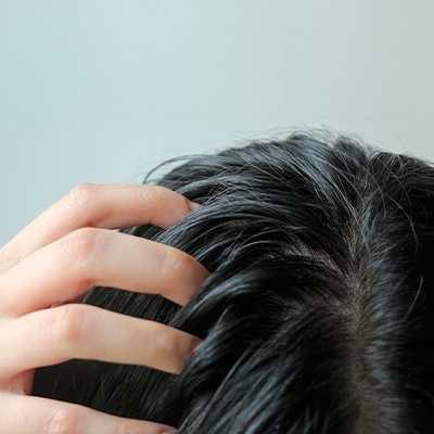 Pessoa tocando o couro cabeludo com fios escuros, destacando aspecto oleoso do cabelo próximo à raiz.
