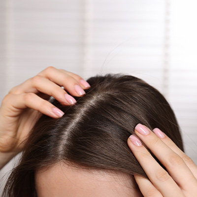 Pessoa examinando o couro cabeludo com as mãos, mostrando a raiz do cabelo e a linha de divisão dos fios.