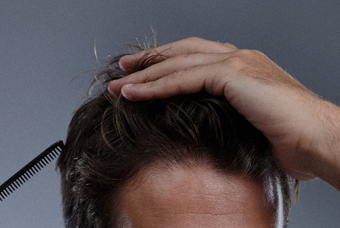 Crescimento capilar: hábitos que fortalecem os fios. 1 Mão sobre o couro cabeludo, afastando os fios para observar a raiz e a densidade do cabelo.