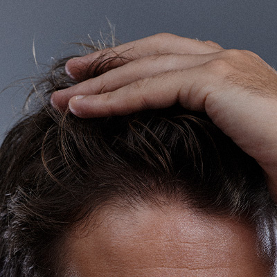 Mão sobre o couro cabeludo, afastando os fios para observar a raiz e a densidade do cabelo.