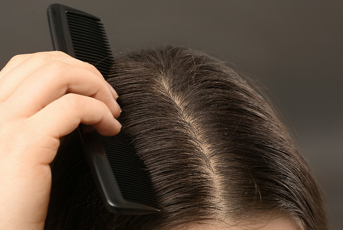 Pessoa penteia o cabelo com pente, evidenciando o couro cabeludo e os fios em detalhe.