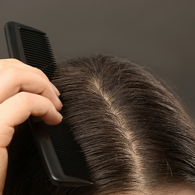 Pessoa penteia o cabelo com pente, evidenciando o couro cabeludo e os fios em detalhe.