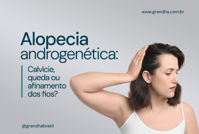 Arte sobre alopecia androgenética e queda de cabelo